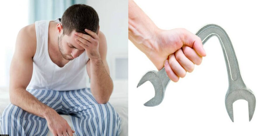 Sintomi di prostatite